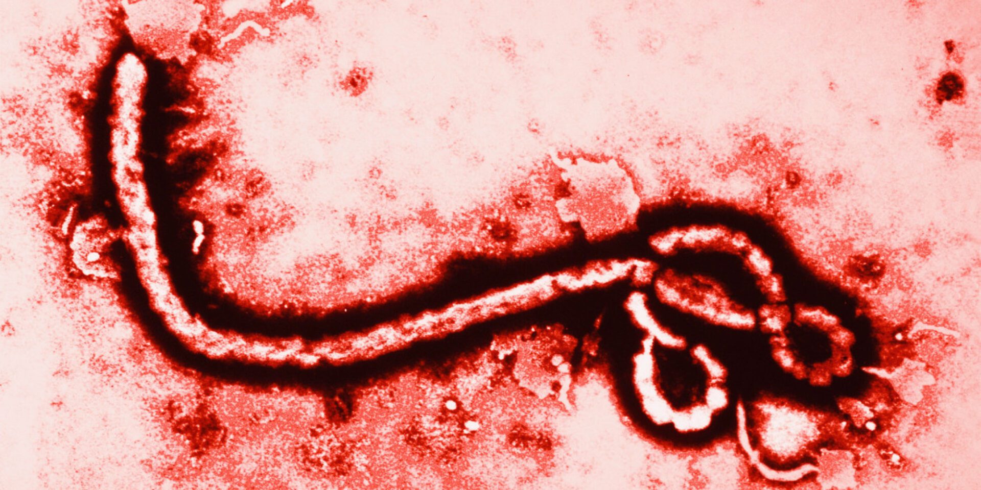 OPINION: Ebola – Will it finally break into mainstream media?