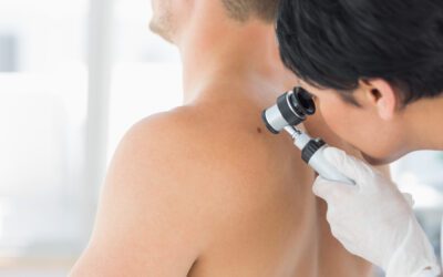 Skin cancer statistics stabalise, despite tanning culture