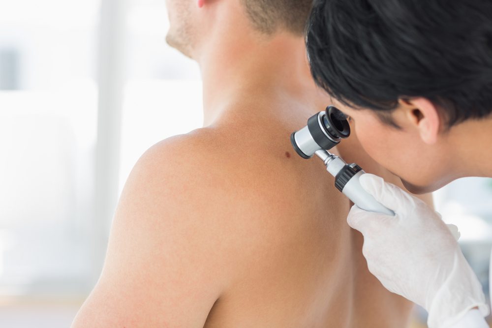 Skin cancer statistics stabalise, despite tanning culture